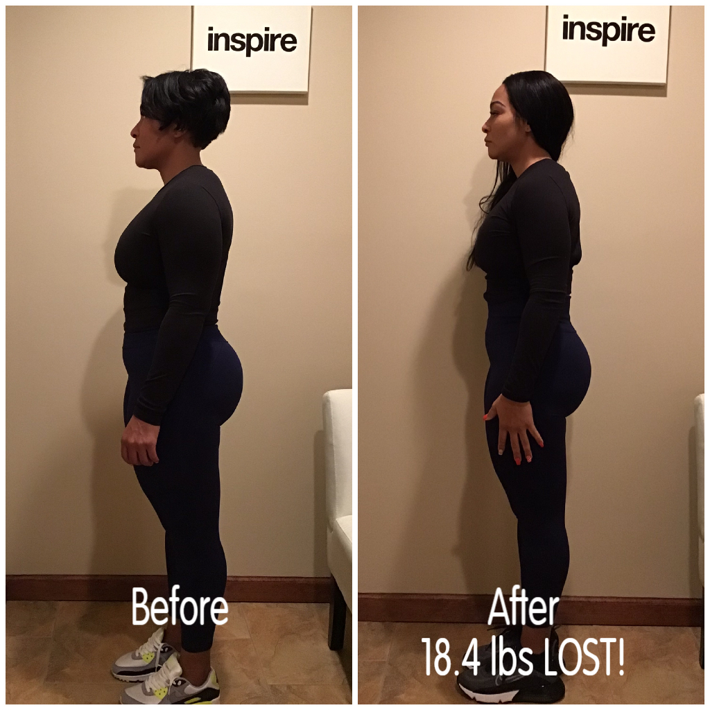Inspire client AM, lost 18.4 pounds
