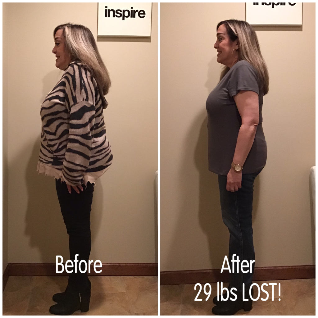 Inspire client DS, lost 29 pounds