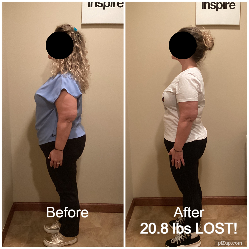 Inspire client EM, lost 20.8 pounds