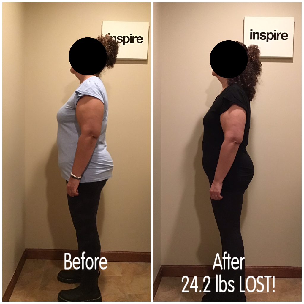 Inspire client KR, lost 24.2 pounds