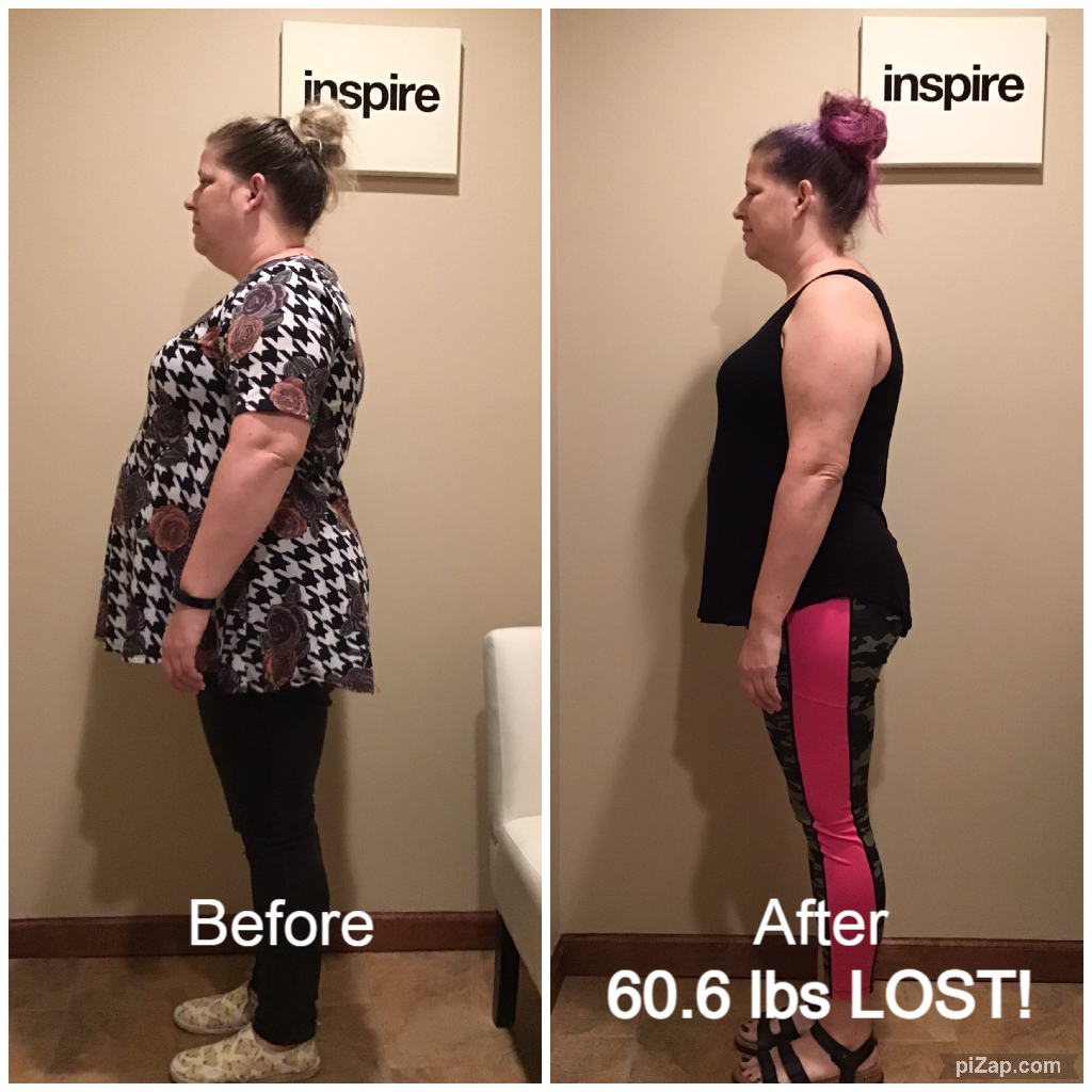 Inspire client KR, lost 60.6 pounds