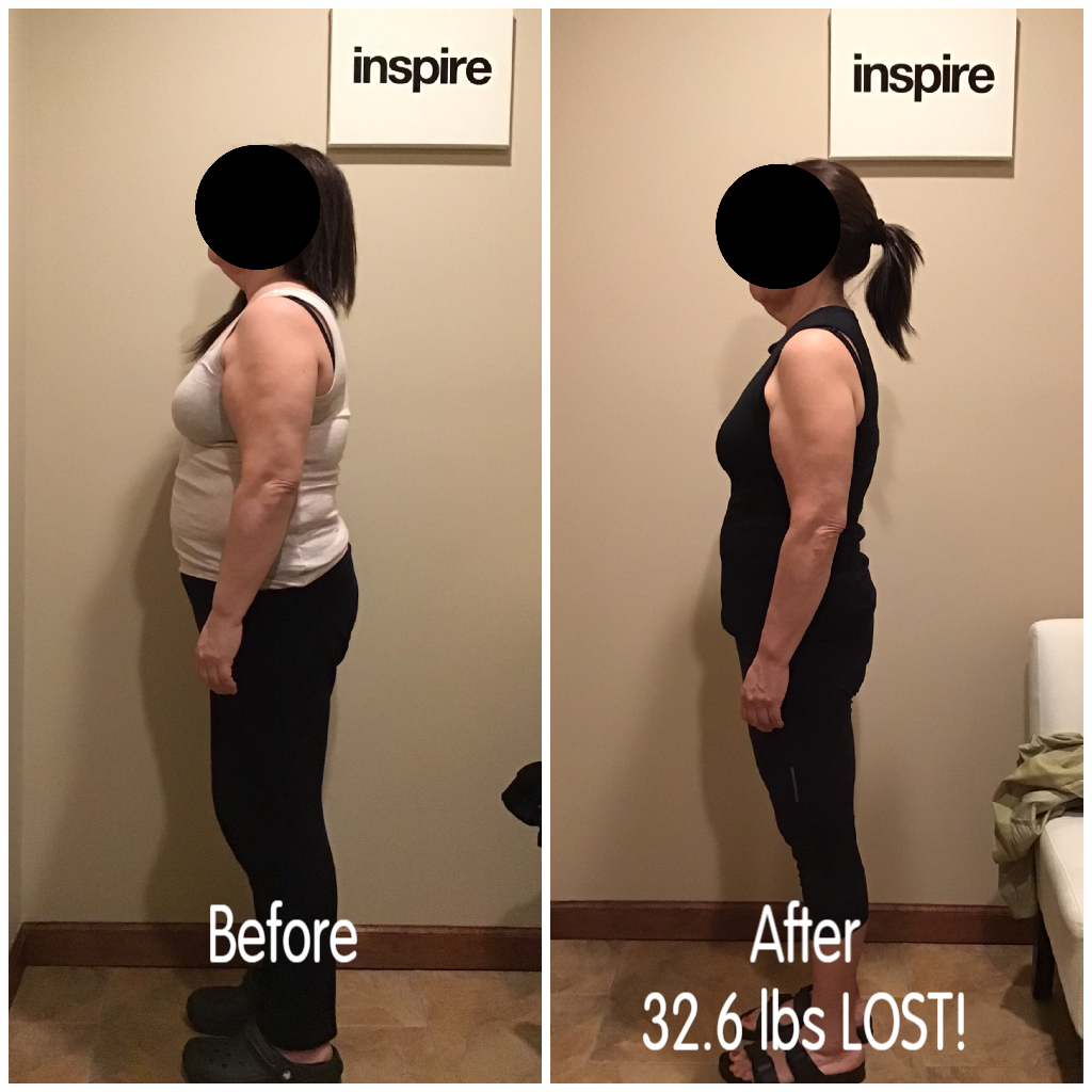 Inspire client LP, lost 32.6 pounds