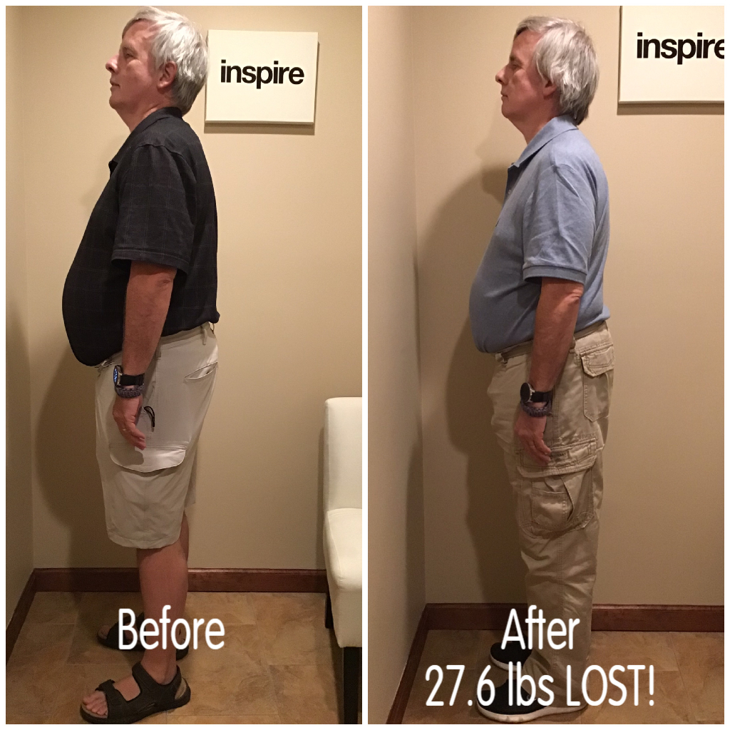 Inspire client LS, lost 27.6 pounds