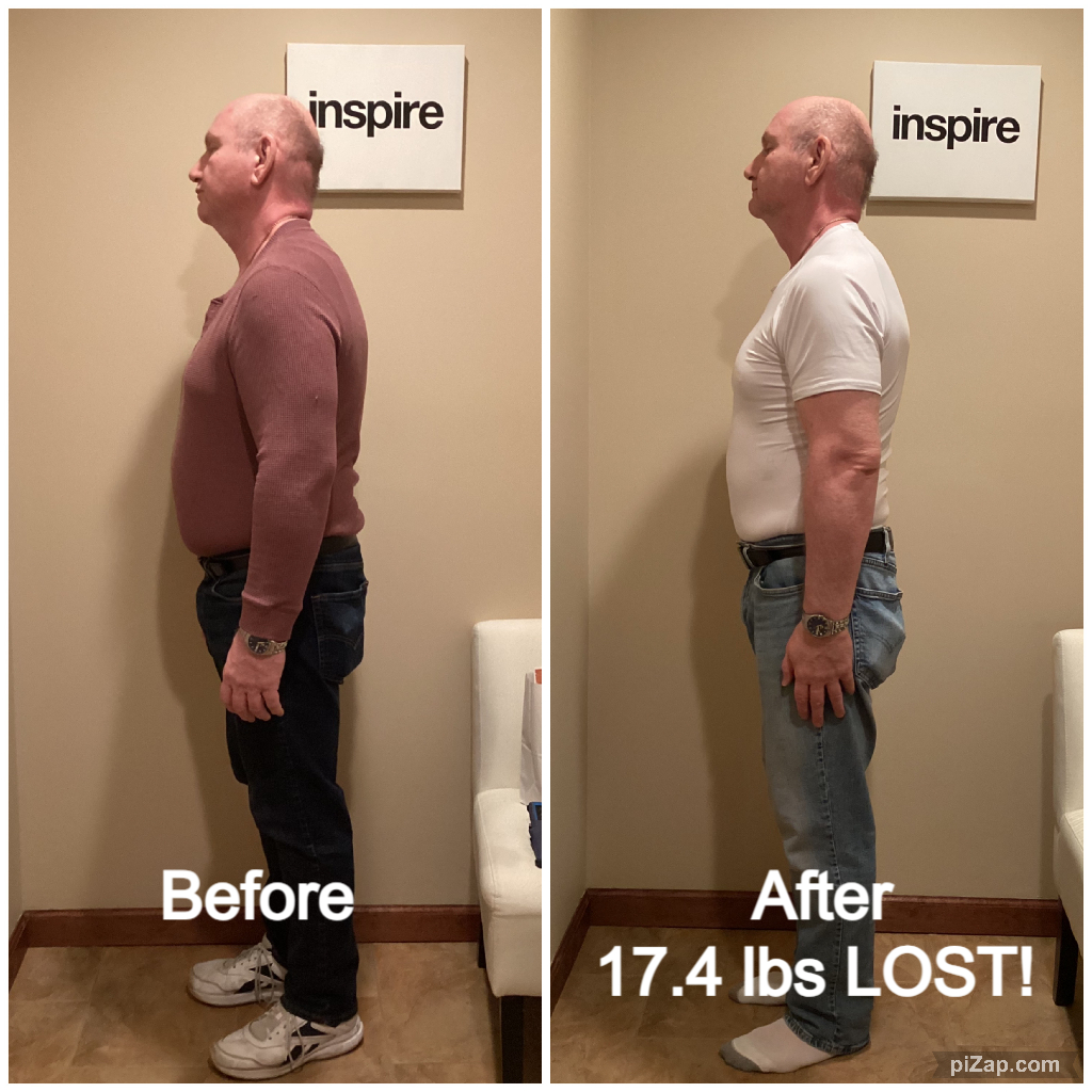 Inspire client PB, lost 17.4 pounds