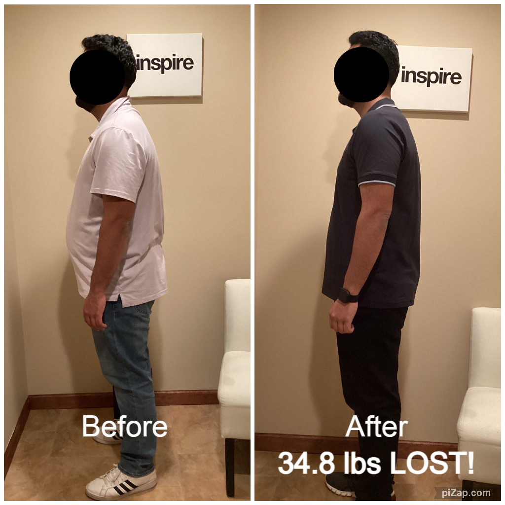 Inspire client RT, lost 34.8 pounds