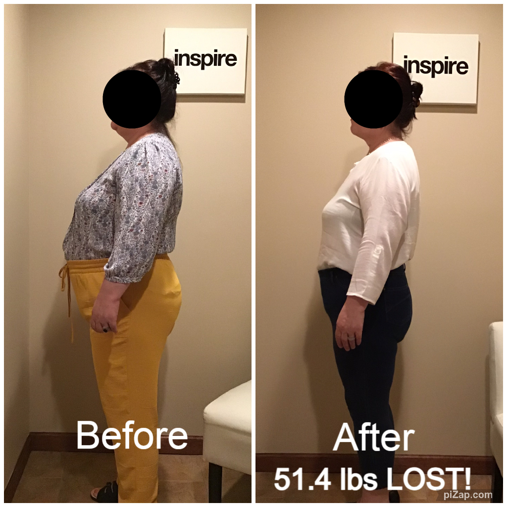 Inspire client SA, lost 51.4 pounds